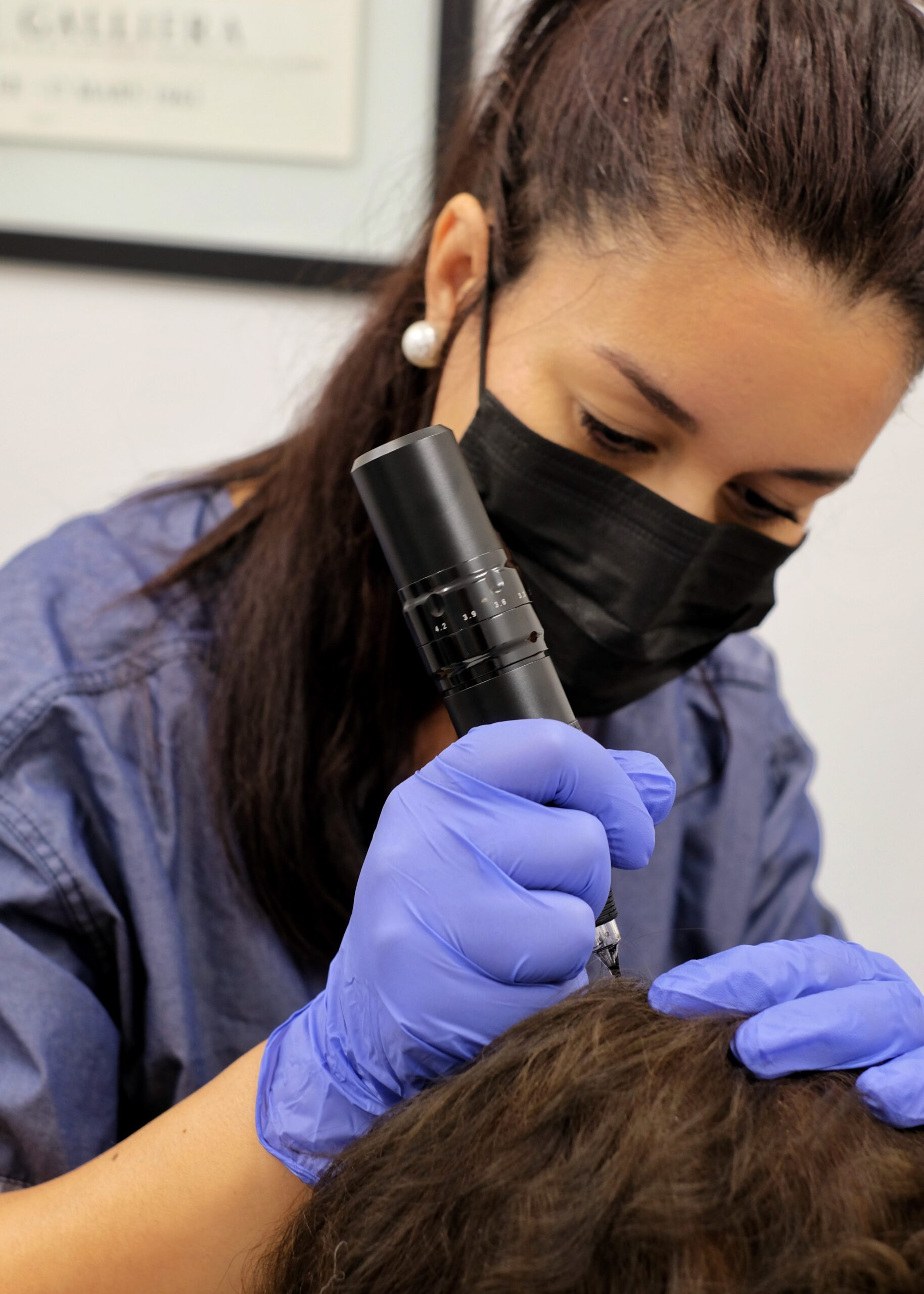 séance de tricopigmentation au cabinet de médecin esthétique du docteur martial bodnar à toulouse