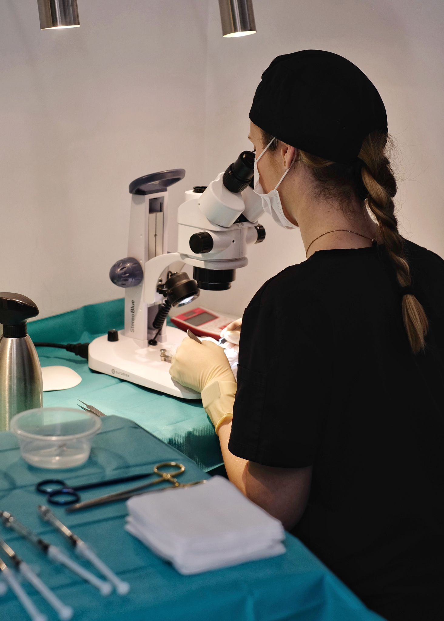 analyse des greffons lors d'une greffe de cheveux réalisée au cabinet du docteur martial bodnar