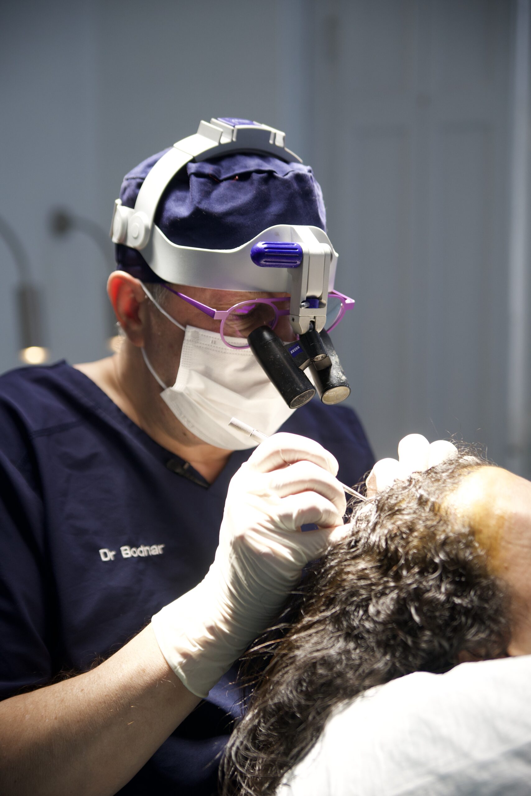 intervention d'une greffe de cheveux par le docteur martial bodnar